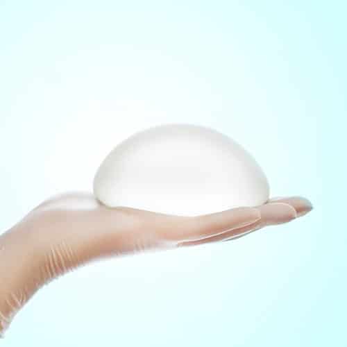 Breast implants : when should I change them ?