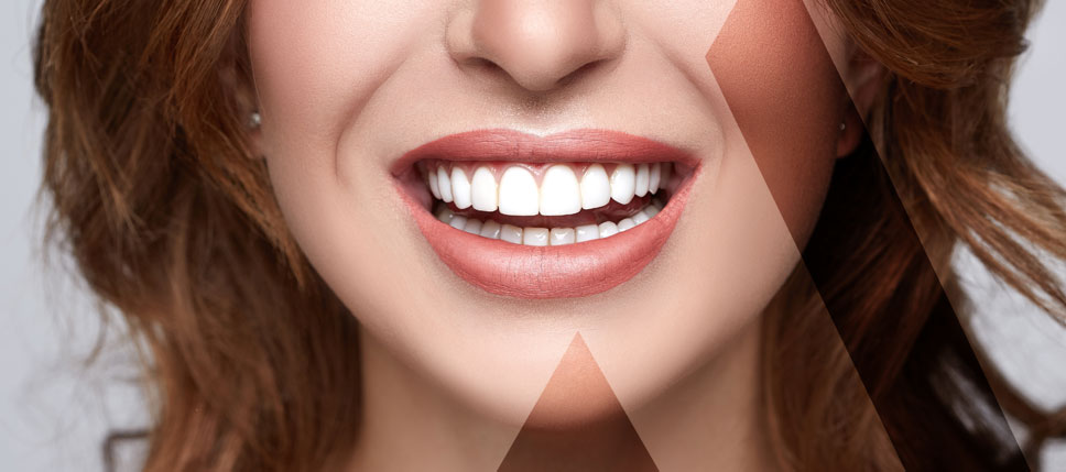 dental-whitening-Turkey