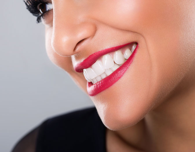 Dental whitening