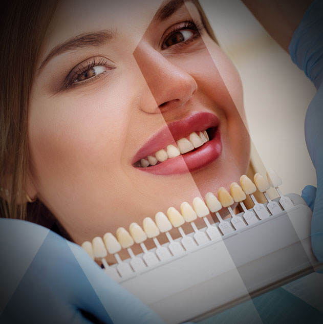 dental-veneers-turkey