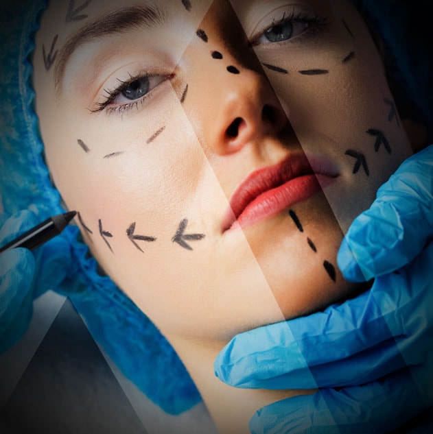 endoscopic-facelift-turkey