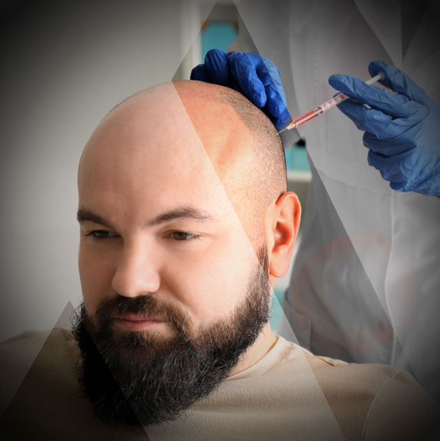 hair-transplant-turkey